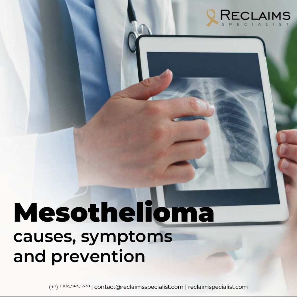 Mesothelioma Causes, Symptoms, and Prevention